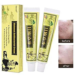Psoriasis Treatment,Psoriasis Cream for Dermatitis, Eczema,Natural Chinese Herbal Cream Eczema Dermatitis Psoriasis Vitiligo Skin Disease Treatment, 2pc